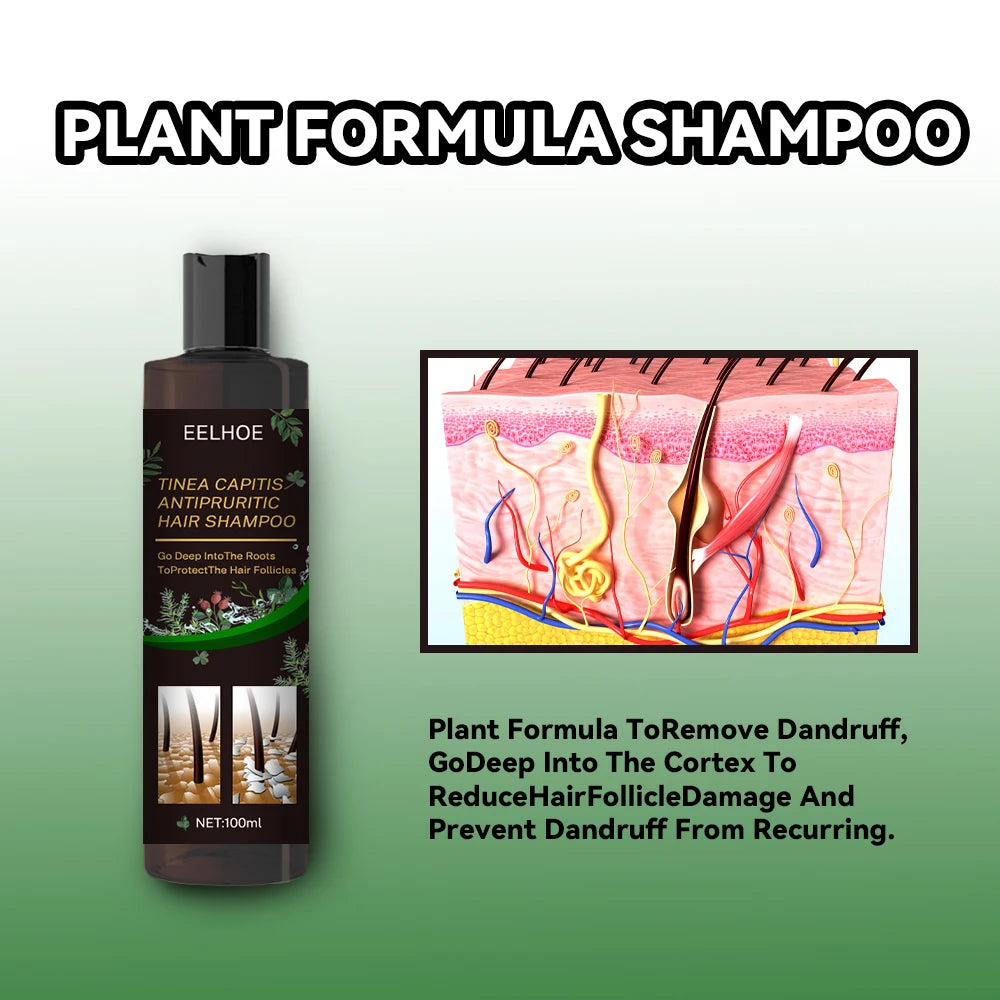 EELHOE Hair Cleaning Shampoo Anti Dandruff Remove Mites Relieve Itching Oil Control Scalp Cleaning Refreshing Hair Shampoo