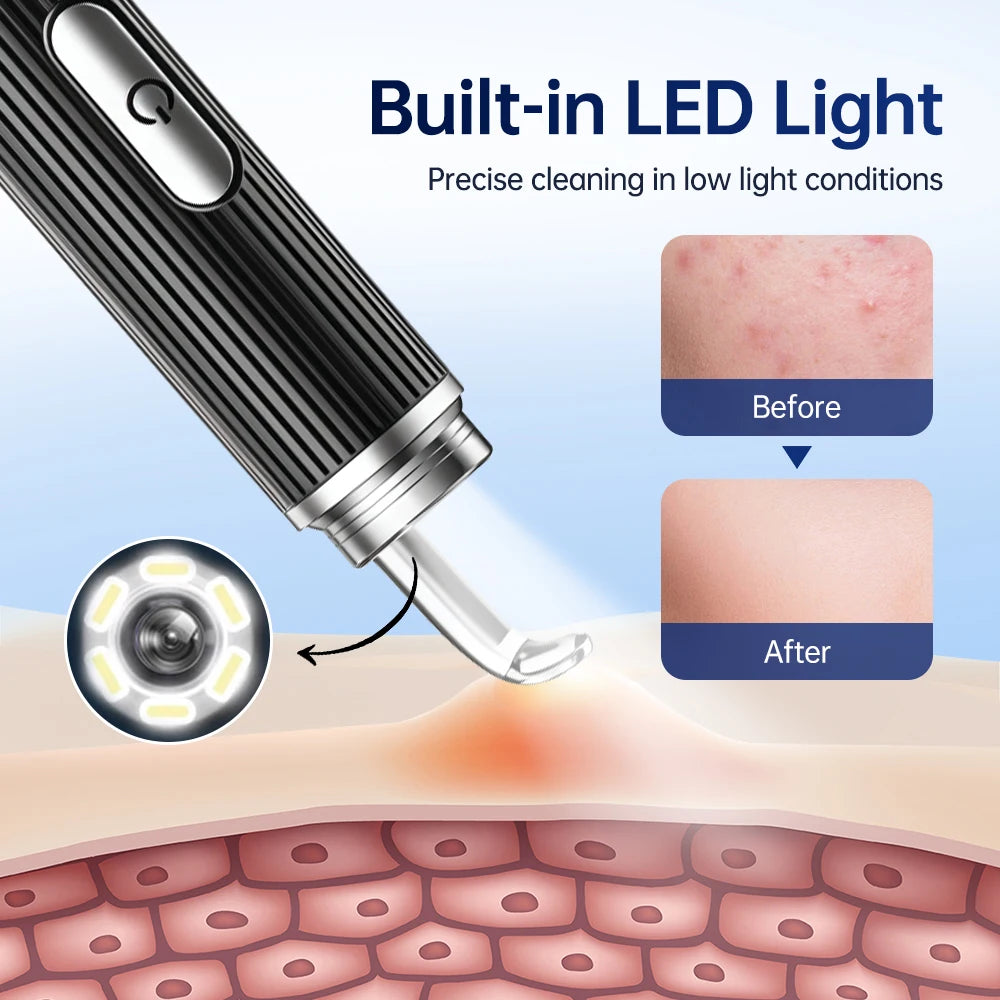 Visual Blackhead Remover 1296P HD Camera 50X Magnification Face Pimple Acne Pore Deep Clean Care Set Smart Blackhead Removal