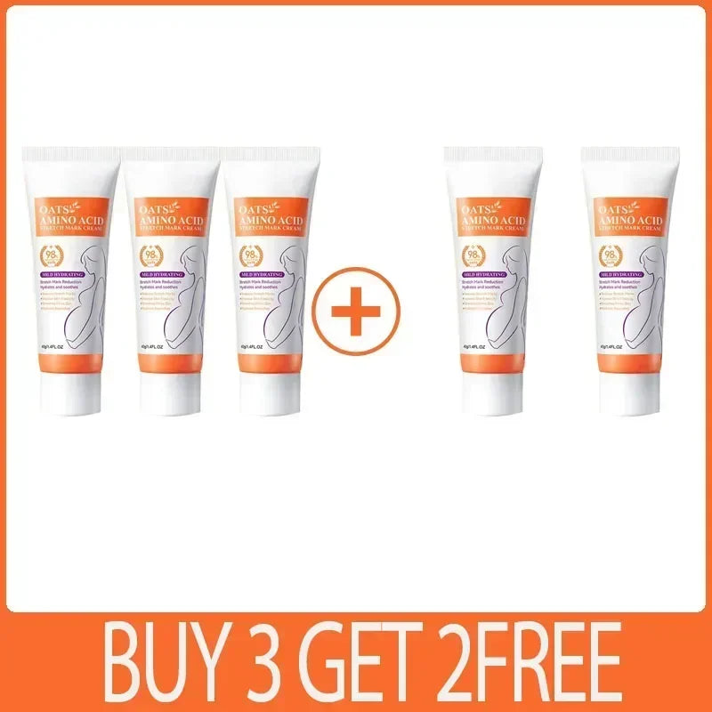 Cream For Pregnancy Stretch Marks Removal Eliminate Red White Old Stretch Marks 2025