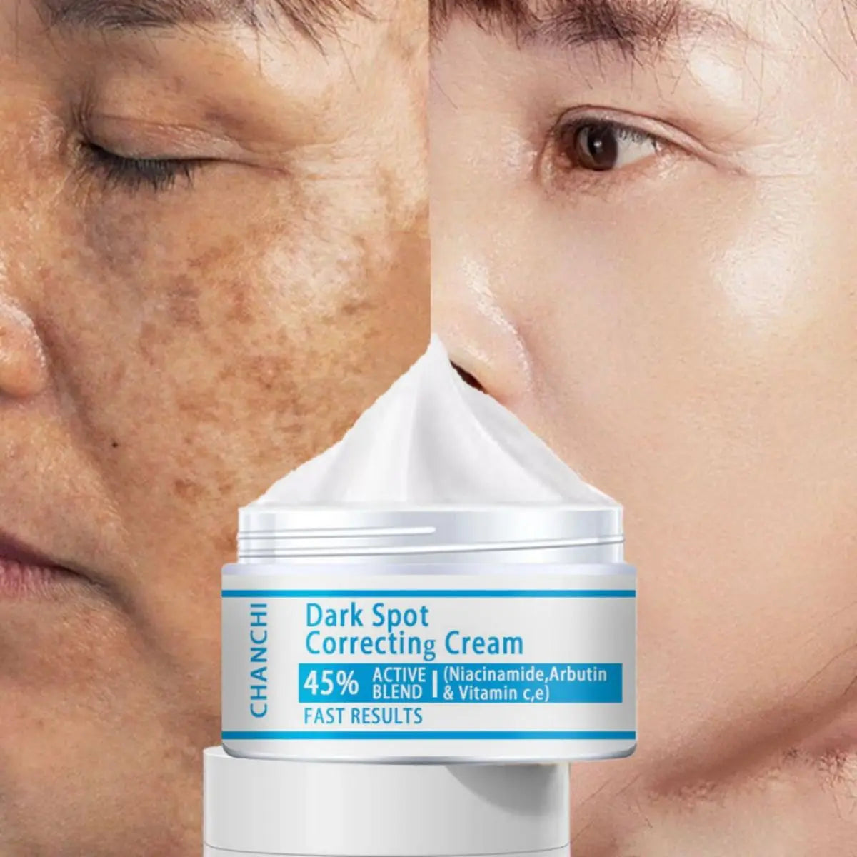 Whitening Freckles Cream Remove Melasma Dark Spot Lightening Melanin Brightening Melasma Remover Moisturize Anti-aging Face Care
