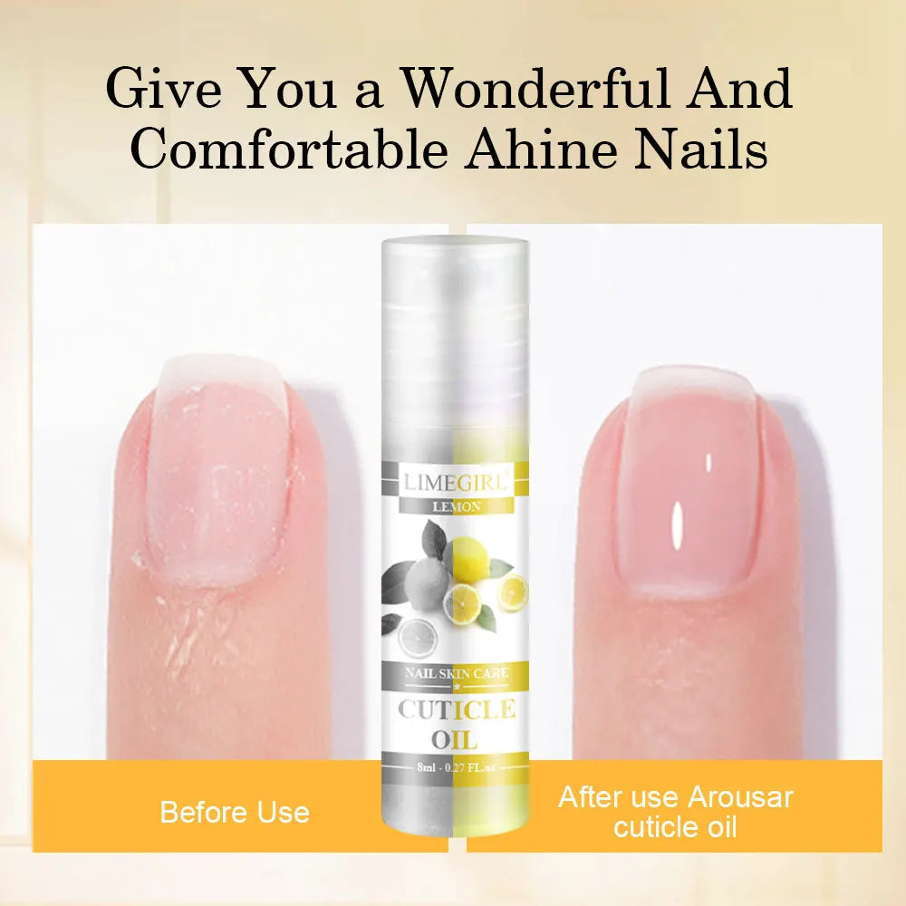 8ml Nail Nutrition Oil Pen 6 Smells Nail Treatment Cuticle Repair Oil Prevent Agnail Nail Polish Nourish Skin Remedy Manicure