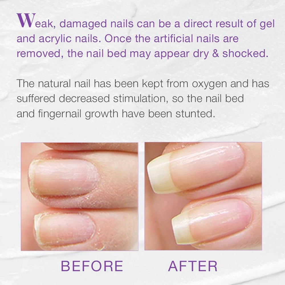 KODIES GEL Nail Strengthener 12ML Professional Nail Art Treatment Hardener Normal Polish Revit for Thin Nails Feet Repair Care