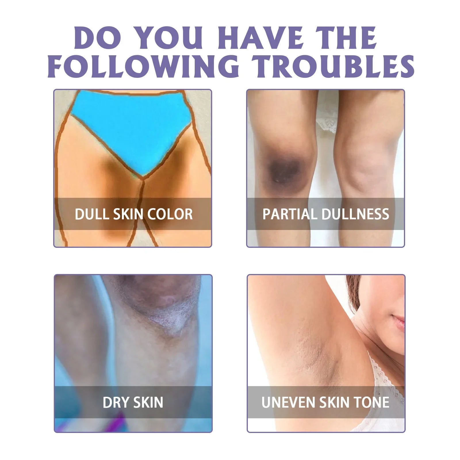 Body Whitening Stick Lighten Armpit Private Parts Melanin Brighten Dark Spot Remover Improve Body Dull Knee Butt Bleaching Cream