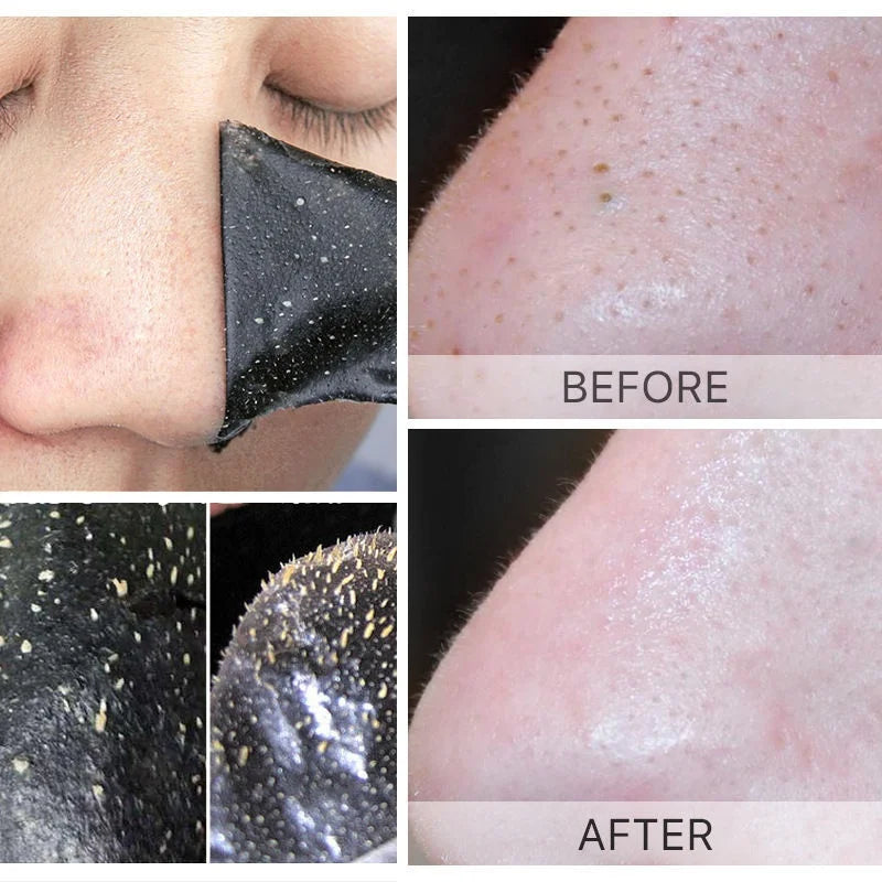 100/50/20/10pcs Bamboo Charcoal Blackhead Remover Black Dots Spots Mask Nose Sticker Cleaner Nose Pore Deep Clean Strip