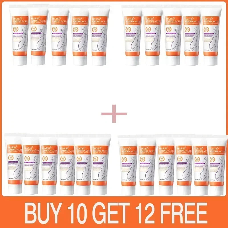 Cream For Pregnancy Stretch Marks Removal Eliminate Red White Old Stretch Marks 2025