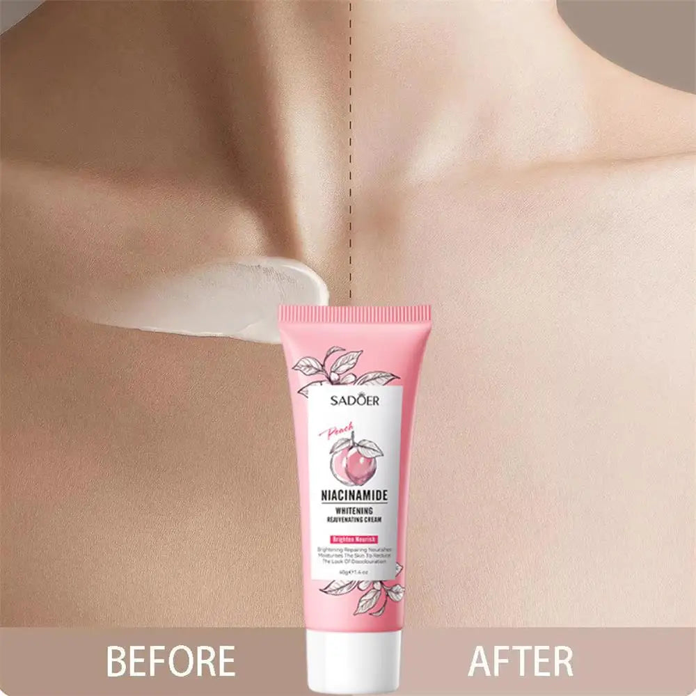 Whitening Cream Private Parts Underarm Butt Knee Whiten Inner Thigh Intimate Parts Dark Remove Melanin Woman Brighten Skin Care