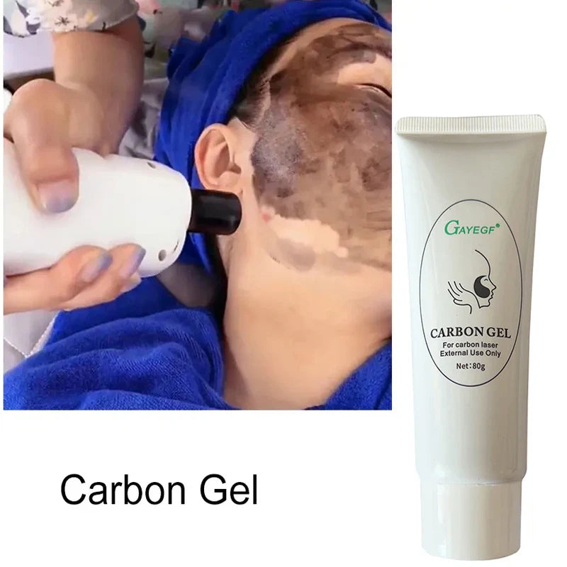Black Gel Mask For ND YAG Laser Skin Peeling Carbon Cream Rejuvenation Whitening Facial Moisturizing Peel Deep Cleaning 80ML/PCS