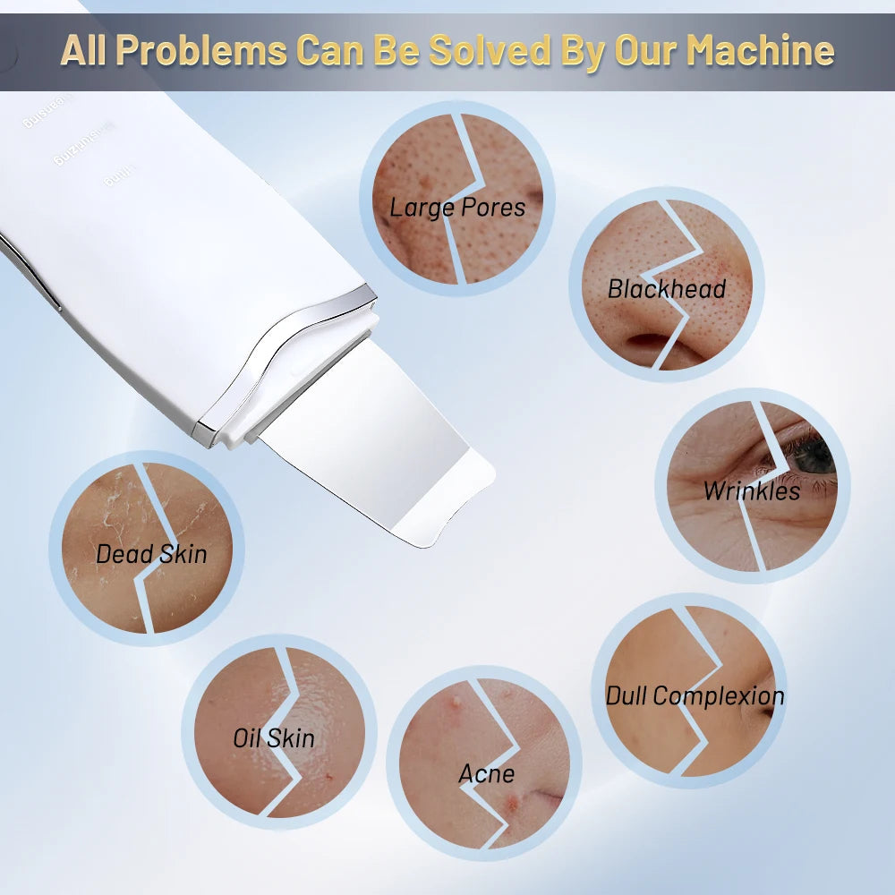 Ultrasonic Skin Scrubber Ance Pore Cleaner Peeling Blackhead Remover Deep Face Cleaning Ultrasonic Ion Facial Shovel Cleanser