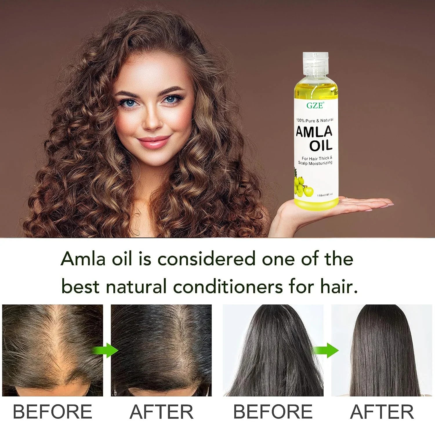 GZE Amla Hair Oil For Healthy Hair Shine and Moisturized Scalp, Indian Hair Oil for Men and Women, Bio Oil for Hair