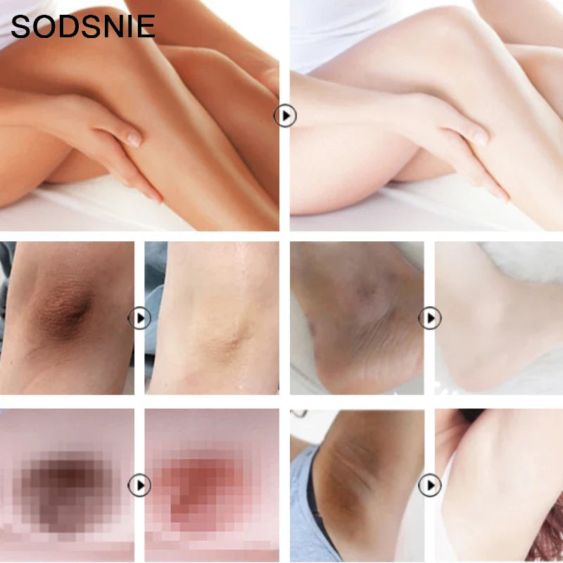 Intimate Whitening Cream Moisturizing Improve Dullness Lighten Dark Spots Improve Pigmentation Private Area Brighten 50g