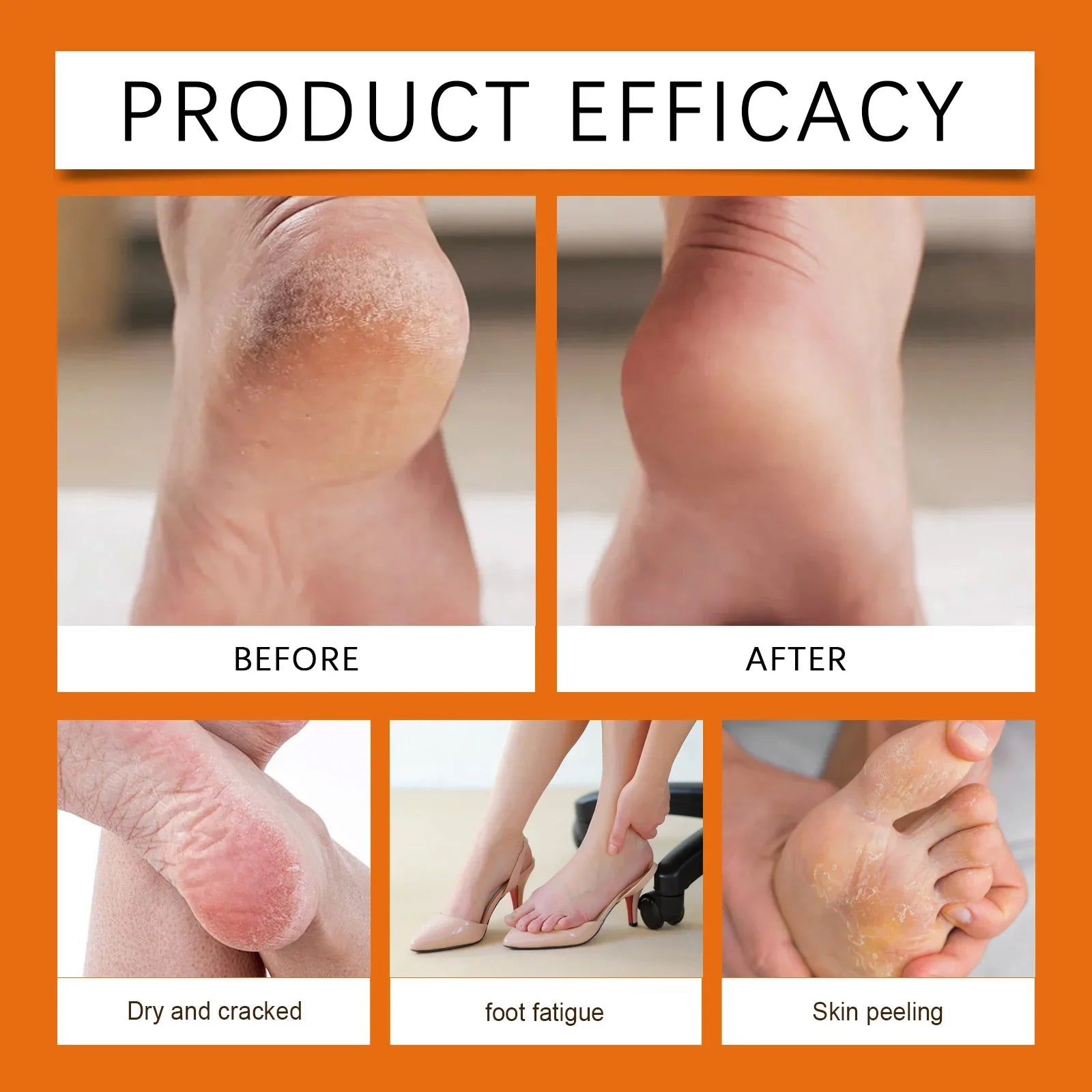 Honey Foot Care Cream Stick Dry Cracked Feet Heel Gentle Exfoliation Softening Skin Ultra-Hydrating Hand Foot Cream Foot Balm