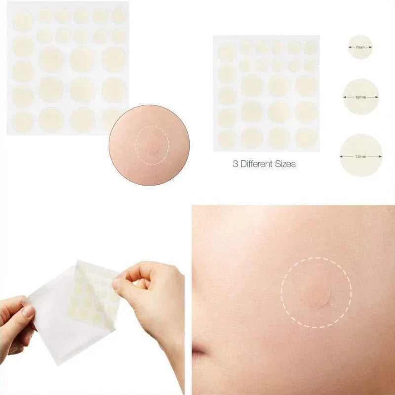 3 bag (1 bag 24pcs ) Face Acne Pimple Spot Scar Care Treatment Stickers Blackhead Removal Freckle Patches Acne Stickers
