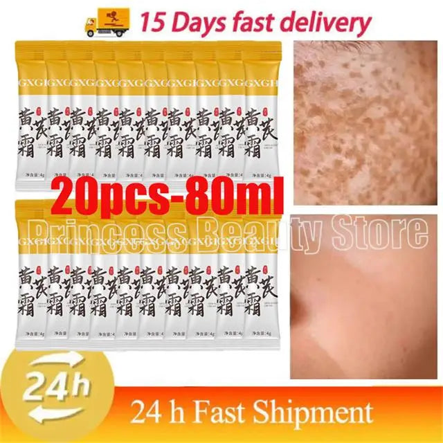 Powerful Spot-removing Whiten Cream Brighten Skin Fast Eliminates Melanin Pigmentation Melasma Dark Spots Moisturize Beauty Gel