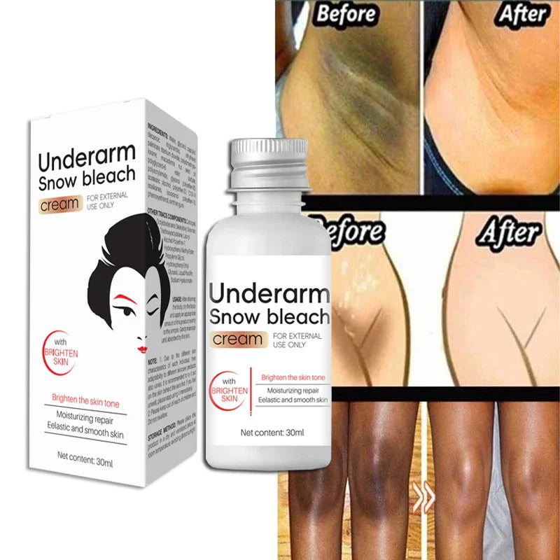 Whitening Cream Private Parts Underarm Bleaching Serum Whiten Butt Knee Brighten Inner Thigh Intimate Parts Dark Remove Melanin