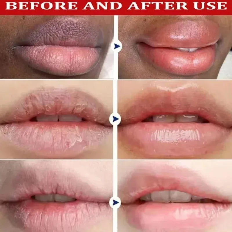 Fast Remove Dark Lip Balm Serum Fade Lip Line Dead Skin Lighten Melanin Lip Mask Exfoliating Moisturizing Repair Lip Care Makeup