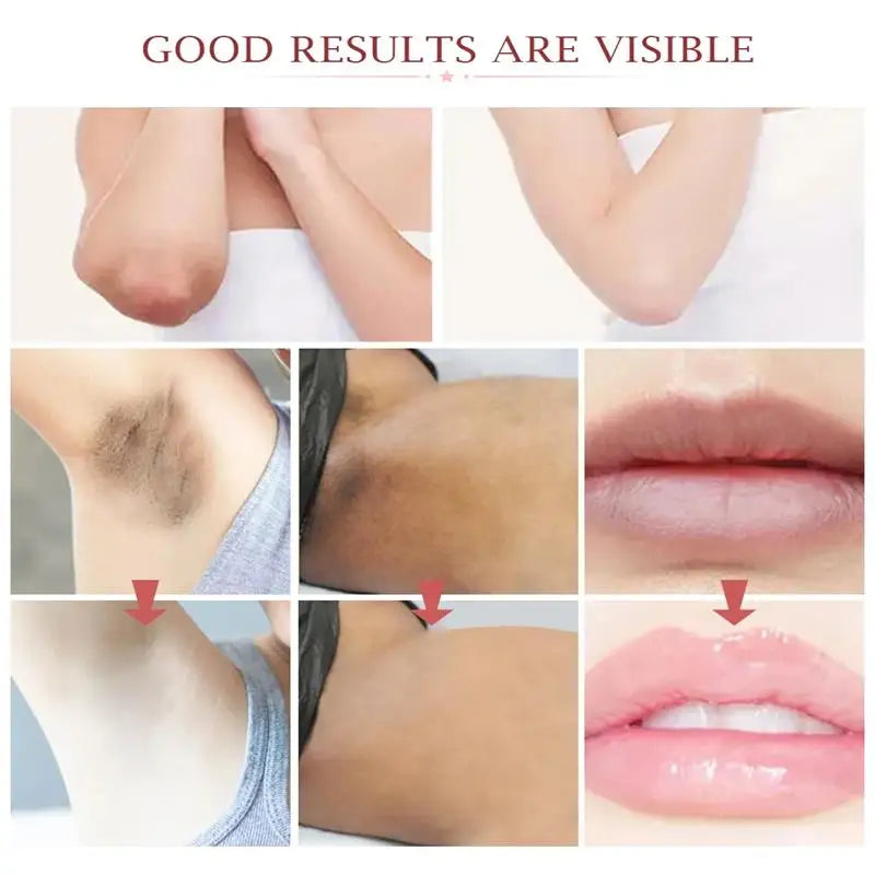 Whitening Cream For Dark Skin Underarm Bleaching Armpit Lightening And Intimate Area Woman Moisturizer Korean Skin Care Products