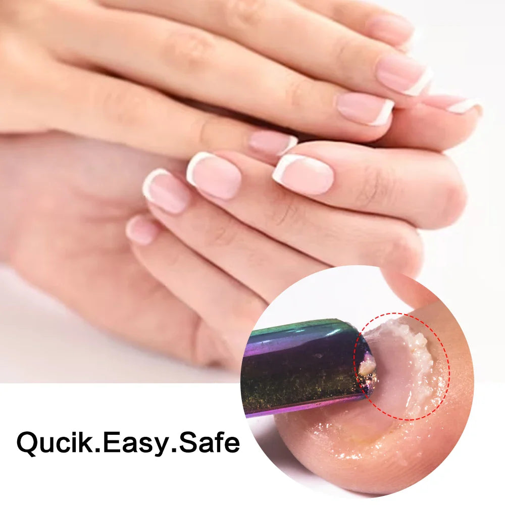 KODIES GEL Cuticle Remover 15ML Gentle Exfoliator Foot Cuticle Oil Softener Liquid Nail Art Treatment Manicure Repair Care Tools