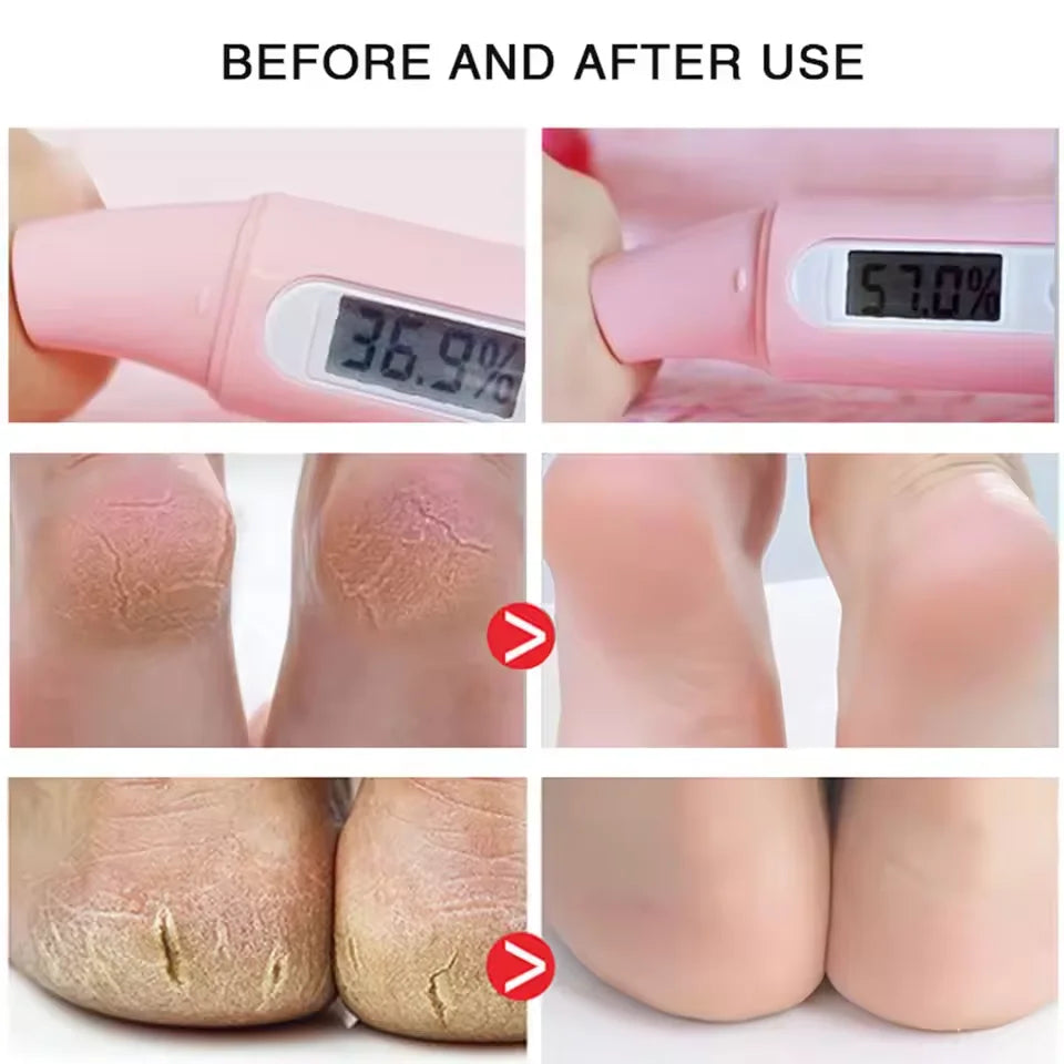 Herbal Anti Crack Foot Cream Spray Heel Cracking Repair Products Exfoliation Dead Skin Removal Softening Moisturize Smooth Care