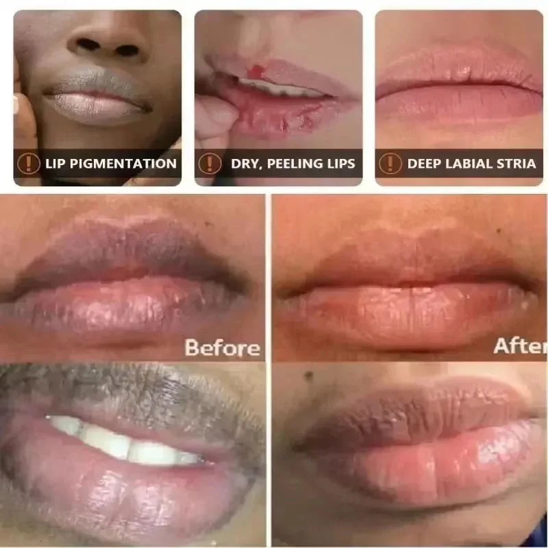 Fast Remove Dark Lip Balm Serum Fade Lip Line Dead Skin Lighten Melanin Lip Mask Exfoliating Moisturizing Repair Lip Care Makeup