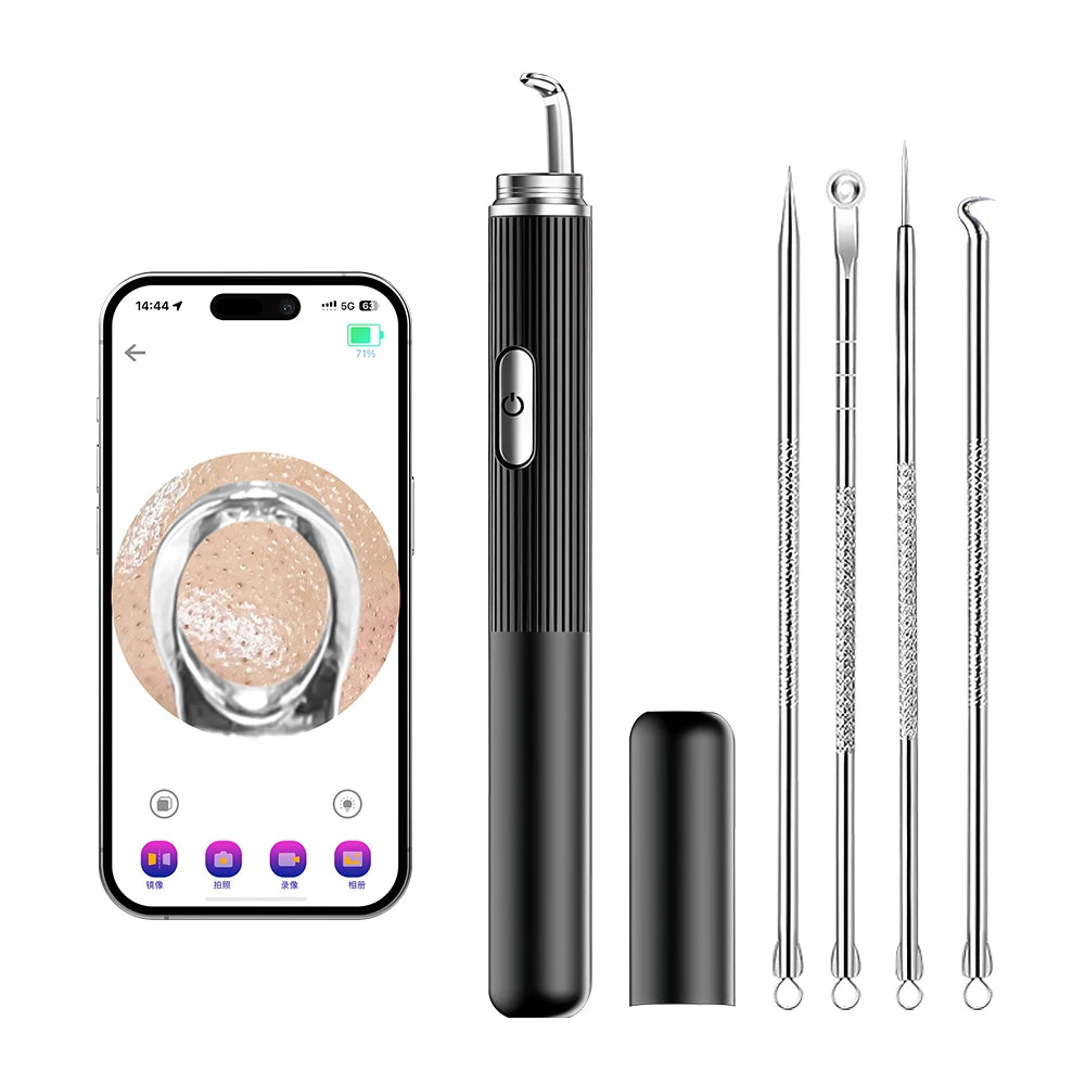 Visual Blackhead Remover 1296P HD Camera 50X Magnification Face Pimple Acne Pore Deep Clean Care Set Smart Blackhead Removal