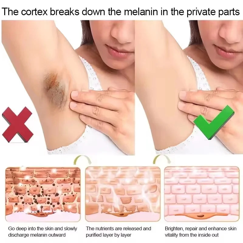 Whitening Cream Private Parts Underarm Butt Knee Whiten Inner Thigh Intimate Parts Dark Remove Melanin Woman Brighten Skin Care