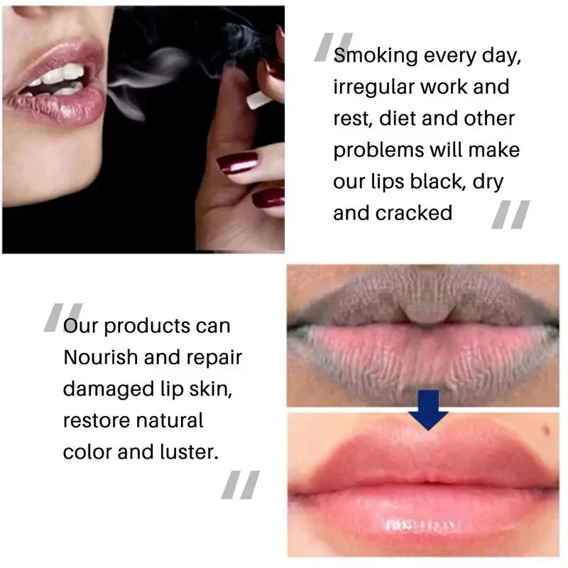 Fast Remove Dark Lip Balm Serum Fade Lip Line Dead Skin Lighten Melanin Lip Mask Exfoliating Moisturizing Repair Lip Care Makeup