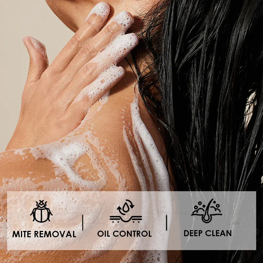 5Pcs Turmeric Soap Lemon Acids Handmade Soap Kojic acid soap Natural Skincare Bar for Moisturizing And Exfoliating Body And Face