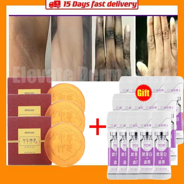 Body Whitening Soap Deep Clean Skin Chicken Skin Removal Soap Armpit Underarm Knees Bleaching Body Brighten White Care Products