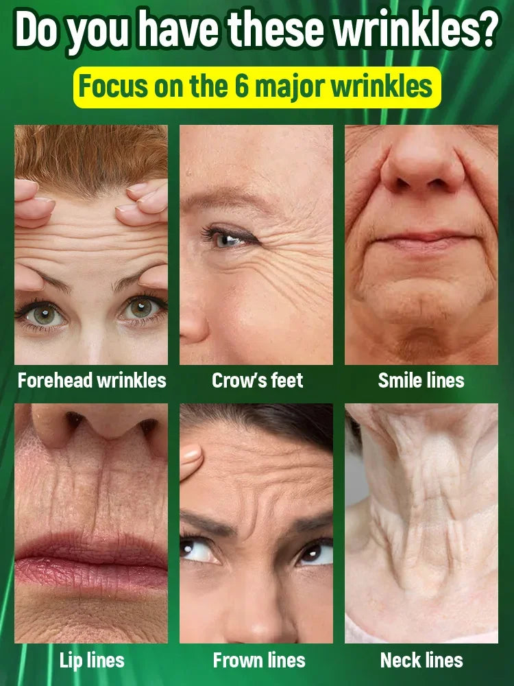 Wrinkles disappear permanently