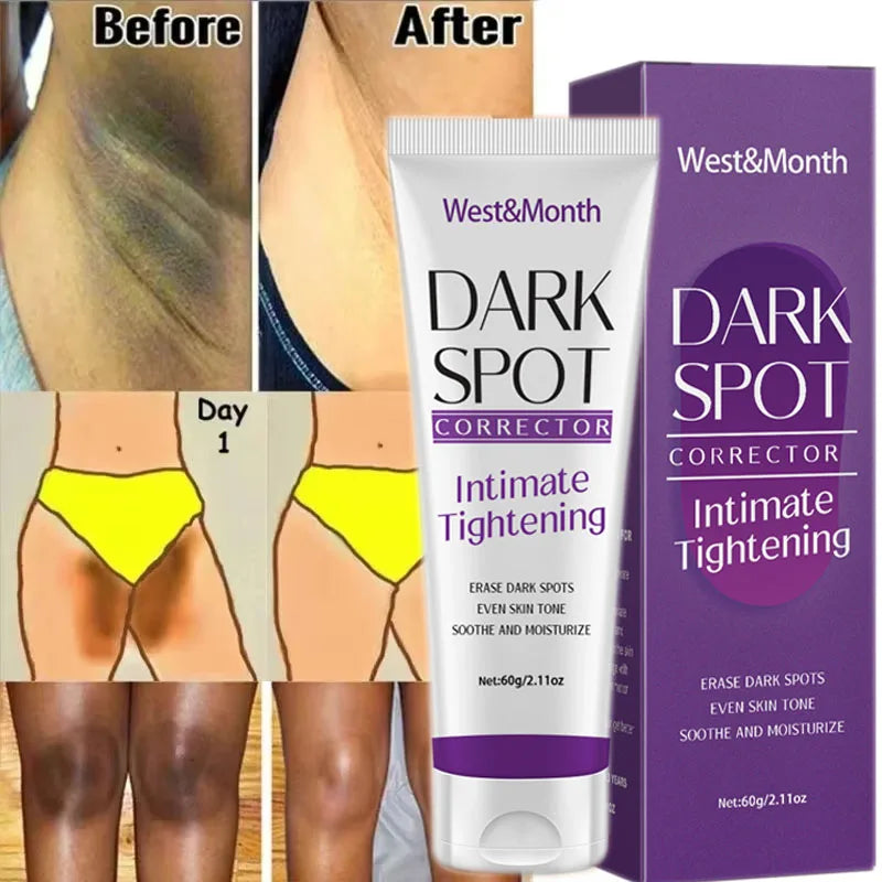 Body Whitening Cream Underarm Knee Buttocks Private Parts Bleach Inner Thighs Intimate Area Remove Melanin Brighten Skin Care