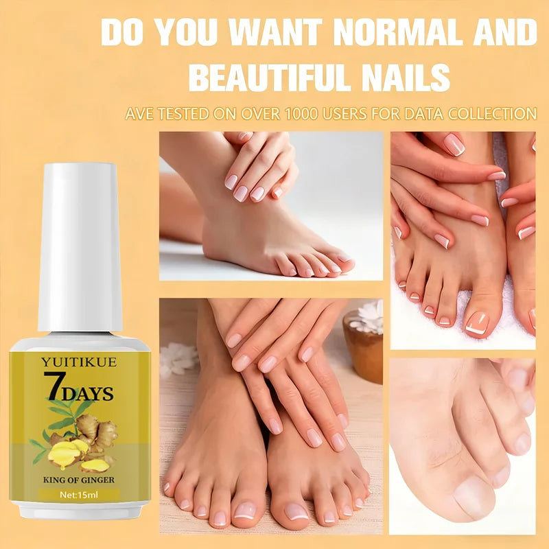 YUITIKUE 7-Day Ginger Nail Care 15ml - Hardens, Smooths & Protects Nails, Max Strength Cuticle Care for Beautiful Nails