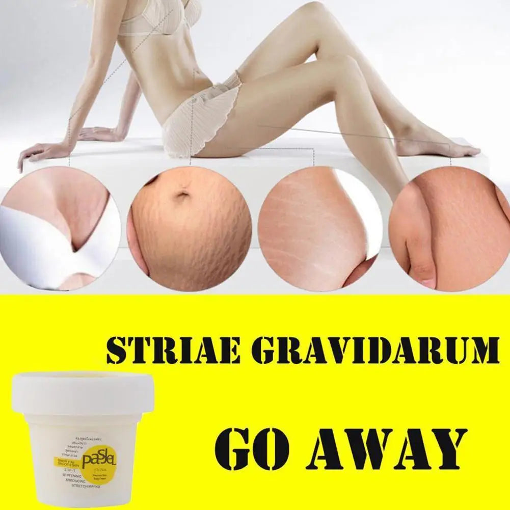 50ml Stretch Mark Repair Cream Powerful Precious Body Scar Postpartum Stretch Marks Obesity Skin Care Remover W1T2