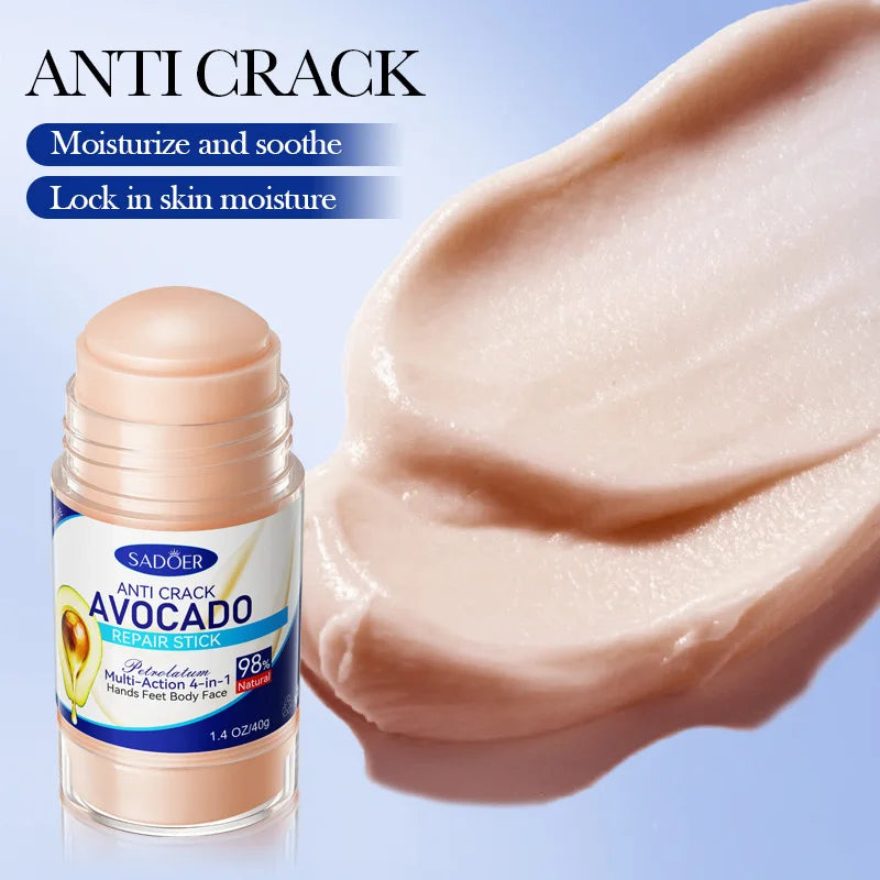 60% Urea Foot Cream Aloe Vera Ultra-hydrating Softening Dry Cracked Feet Cream Gentle Exfoliation Daily Foot Care Solution 40g