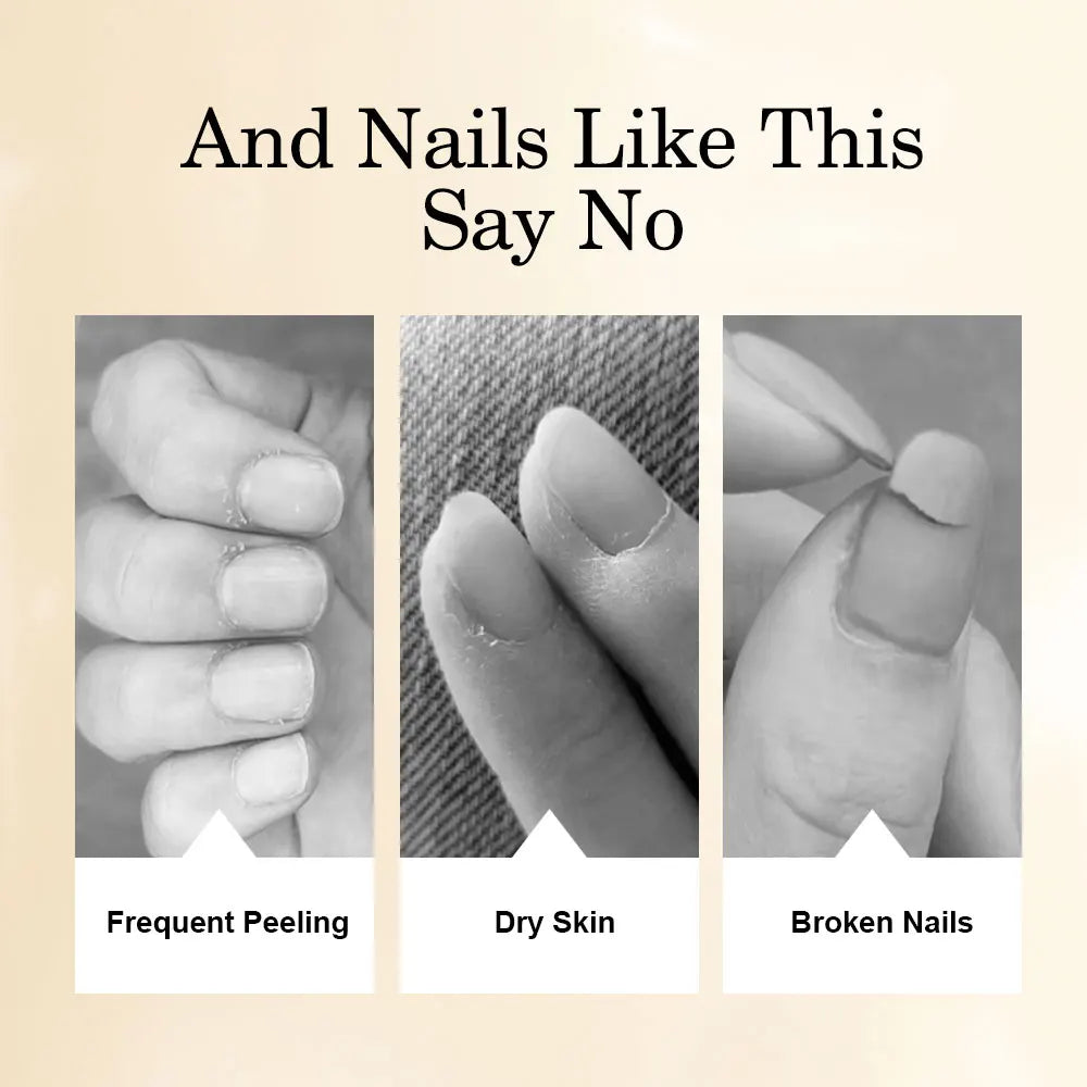 LIMEGIRL 8ml Nail Nutritional Oil 6 Scents Nail Care Cuticle Repair Oil Hangnail Prevention Nourishing Skin Remedy Nail Polish