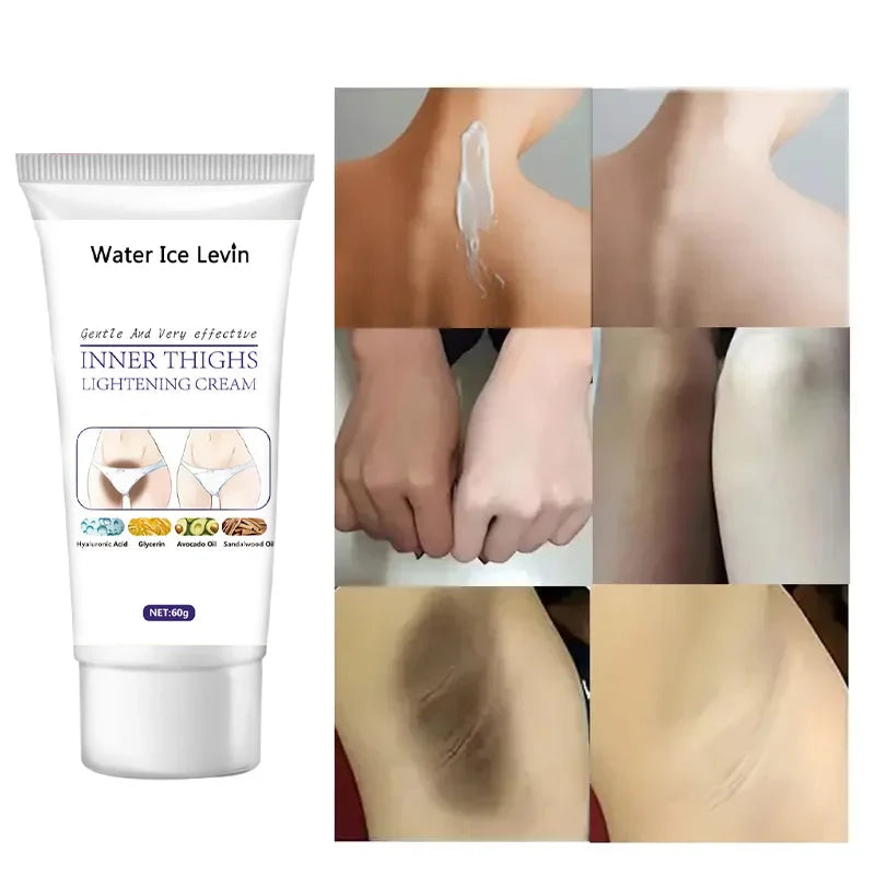 Whitening Cream For Dark Skin Armpit Thigh Inner Joint Lightening Intimate Area Underarm Body Care Private Parts Brighten Lotion