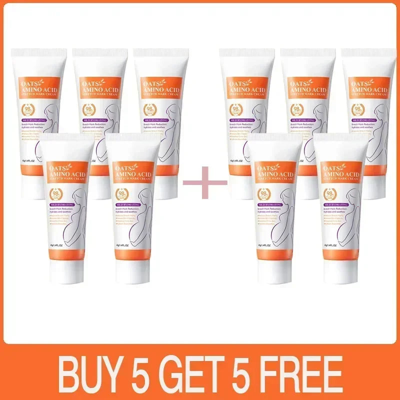 Cream For Pregnancy Stretch Marks Removal Eliminate Red White Old Stretch Marks 2025