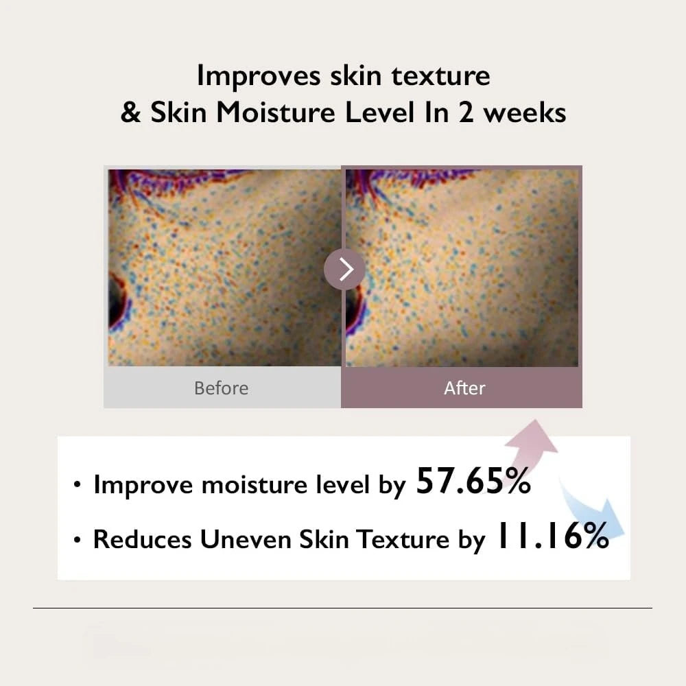 Black Rice Hyaluronic Toner for Sensitive Skin Fragrance Free, Deep Hydration, Glass Skin, Korean Skincare