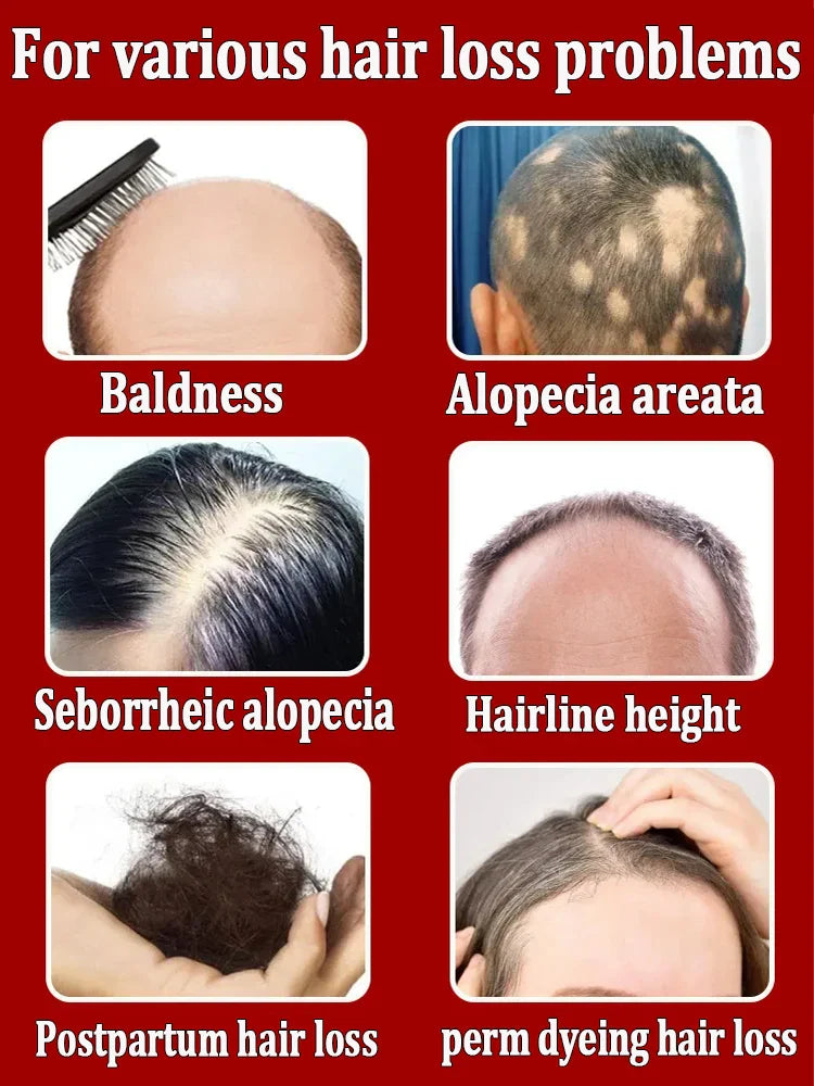 The most effective hair growth essential oil in 2024. Experts authoritatively certified,effective in repairing baldness and hair