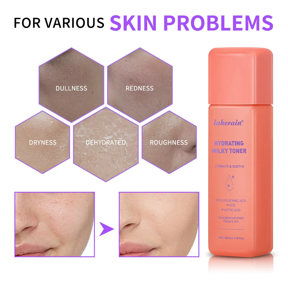 Hydrating Milky Toner Ultra Hydrating Toner for Face Soothes Skin Moisture Reduces Redness Barrier Repair Skincare