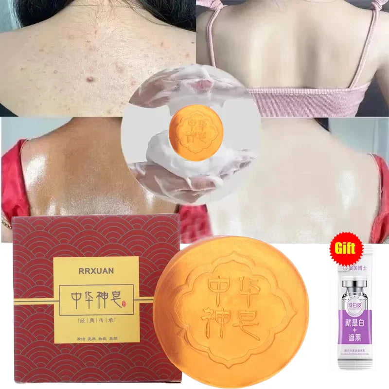 Body Whitening Soap Deep Clean Skin Chicken Skin Removal Soap Armpit Underarm Knees Bleaching Body Brighten White Care Products