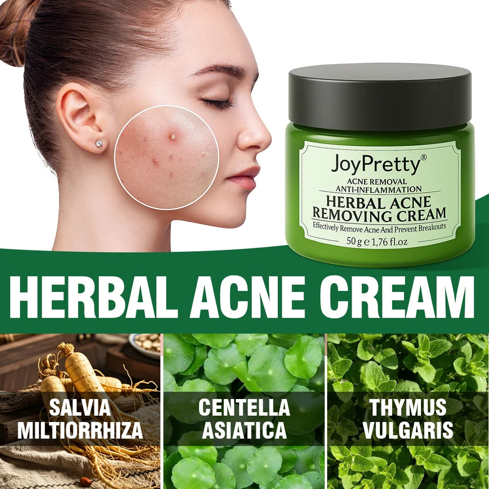 JoyPretty Herbal Acne Treatment Face Cream Elimination Large Pores Oil Control Shrink Pore Facial Cream Skin Care Beauty Health