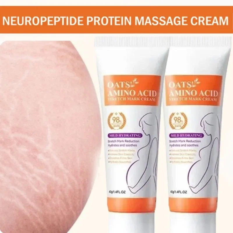 Cream For Pregnancy Stretch Marks Removal Eliminate Red White Old Stretch Marks 2025