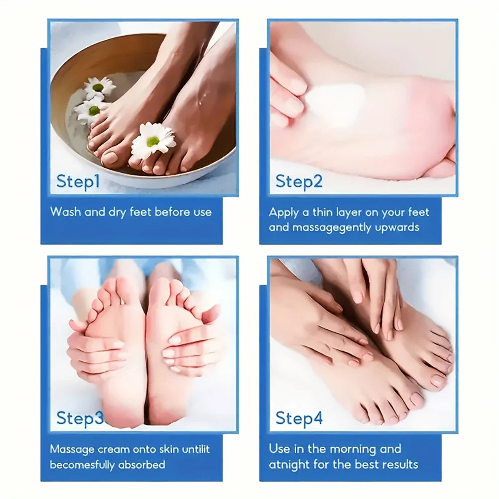 Urea Hand 42% and Foot Cream Softens Moisturizes Skin Relieves Dryness Repairs Cracks Exfoliates Deeply Penetrates Foot Cream
