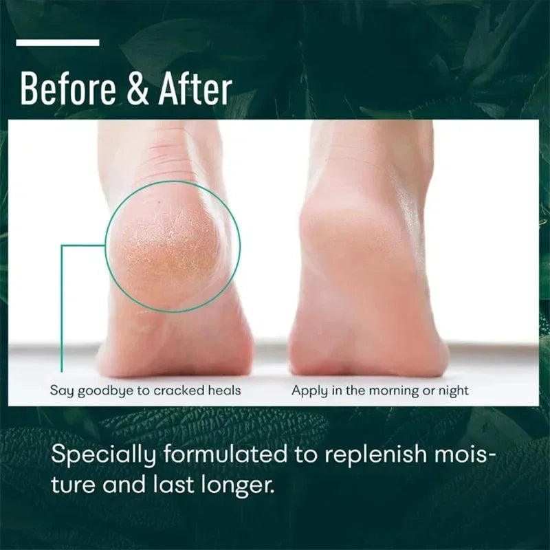 Herbal Anti Crack Foot Cream Heel Cracking Repair Products Exfoliation Dead Skin Removal Softening Moisturize Smooth Skin Care