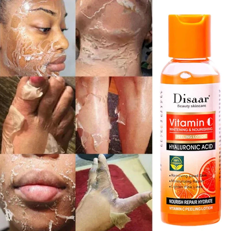 Yellow Peeling Lotion Oil 100% Organic Bleaching Dark Skin Exfoliating Whitening Nourishing Hyaluronic Acid Moisturiz Body Scrub