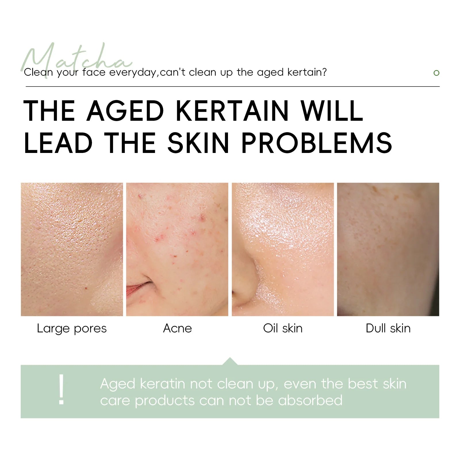 LAIKOU Matcha Exfoliating Gel Exfoliate Peeling Gel Facial Scrub Moisturise Nourishing Repair Scrubs Korean Face Cream Skin Care