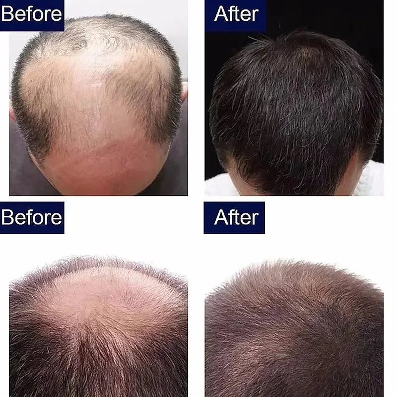 Fast Hair Growth Serum Spray Anti Hair Loss Prevent Baldness Scalp Treatment Repair Roots Beauty Health Hair Care For Men Women