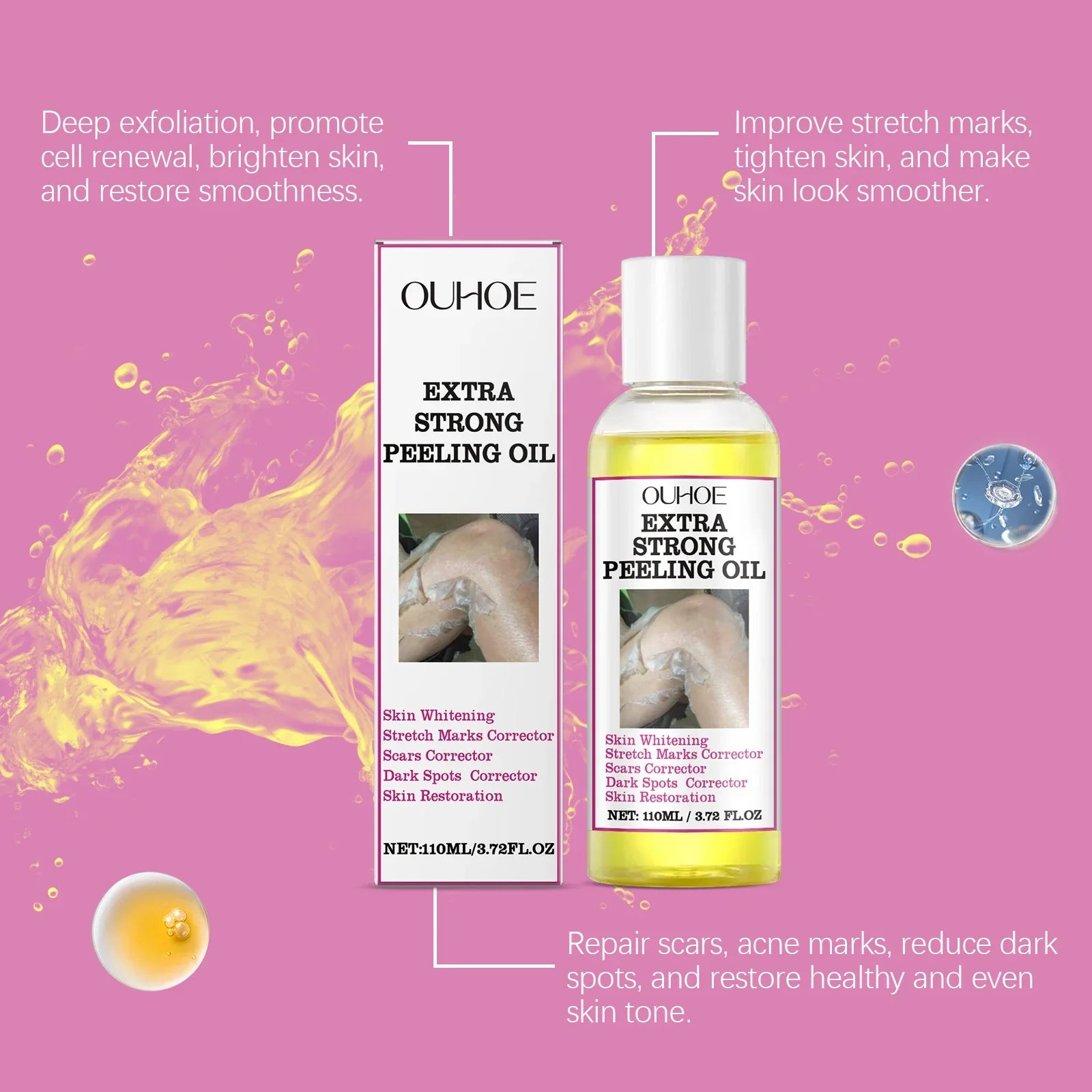 30/110ml Skin Peeling Oil Super Strength Body Peeling Oil Brightening Skin Tone Moisturizing Skin Care Exfoliating Yellow Oil