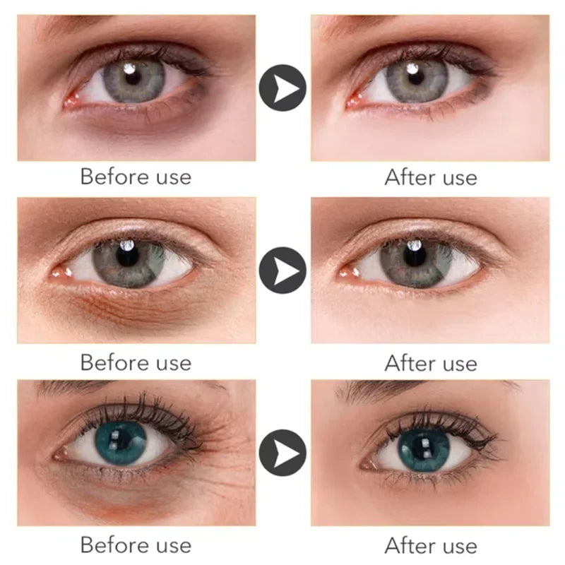 Anti Dark Circle Eye Serum Oil Retinol Anti Wrinkle Firming Skin Remove Eye Bag Fade Fine Line Whitening Brighten Eye Care Korea