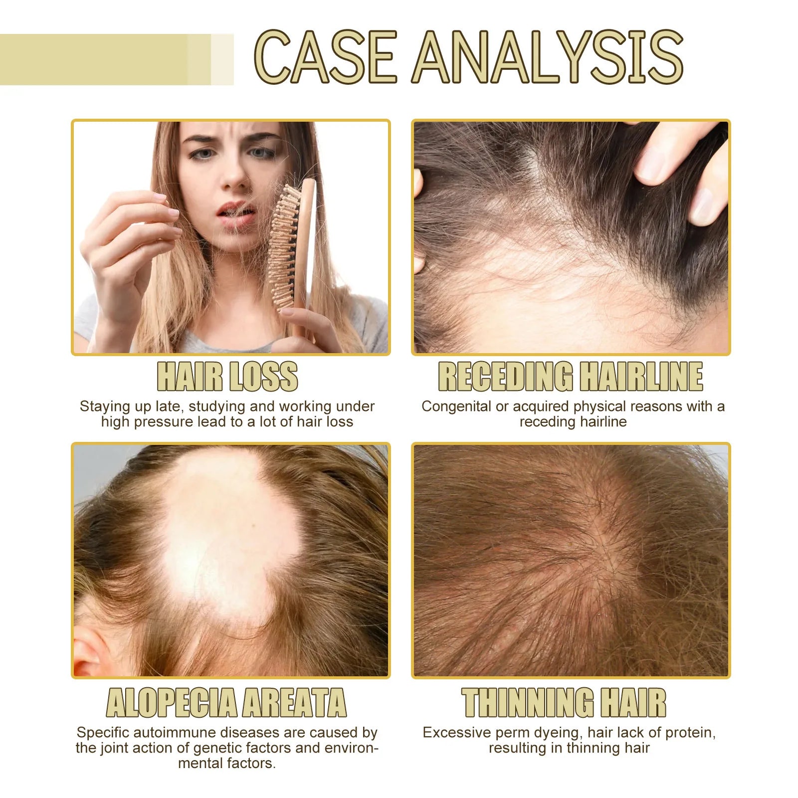 EELHOE Rosemary Oil Hair Growth Products Anti Hair Loss Treatment Volume Hair Thickener Strengthening Rosemary Essential Oil